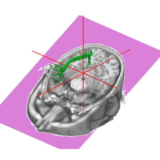 Tractography Viewer